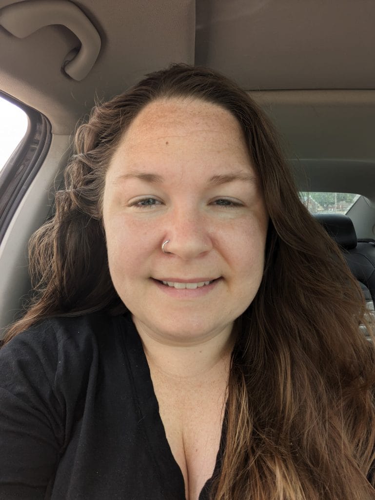 Photo of author in early 2023 right after stopping care with the functional medicine doctor starting my chronic illness journey, very inflamed.